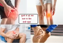knee-pain-treatment-at-home-in-winter-sardi-mein-ghutno-ke-dard-ko-kam-karne-ke-nuskhe