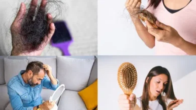 Hairfall-causes-prevention-treatment balo-ka-jhadna-kaise-roke